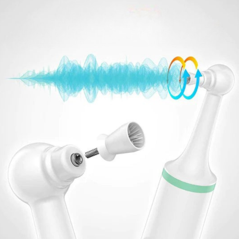 Ηλεκτρικός αφαλατωτής δοντιών - Oral Hygiene & Radiant Smiles